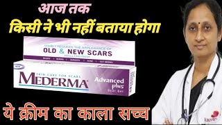 Mederma cream  Mederma for acne scars  Mederma advanced scar gel review [upl. by Andreas285]