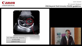 Dr Laurent Guibaud  CNS Beyond 2nd Trimester ISUOG Guidelines [upl. by Pugh]