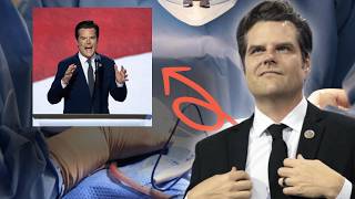 Plastic Surgeon Reveals What Happened to Matt Gaetz’s Face [upl. by Ahsaekal]