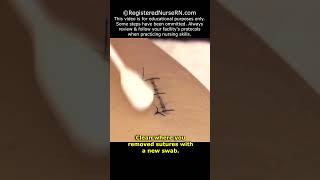 How to Remove Stitches Sutures Nursing Clinical Skill shorts nursing nurse [upl. by Penman]