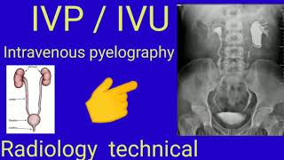 IVP  IVU  Intravenous pyelography  Radiology  Radiography  By BL kumawat [upl. by Edia]