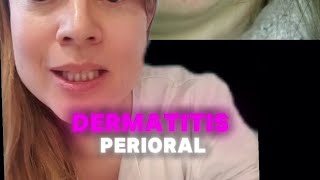 Dermatitis perioral [upl. by Arlen]