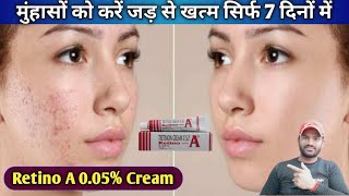 Retino A 005 Cream use dose benefits and side effects full review in hindi [upl. by Verneuil868]