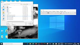 Image J Software how we can find size of the nanoparticles [upl. by Aniv]