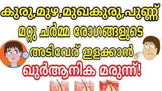 Dua for skin disease in islam ചർമ രോഗങ്ങൾ മാറാൻ Quranic medicine [upl. by Alaham]