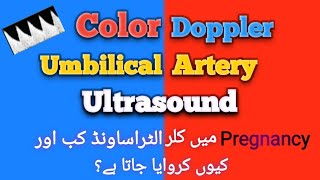 Umbilical Artery Doppler Ultrasound  Color Doppler scan in Pregnancy  IUGR  pregnancy sonography [upl. by Deina]