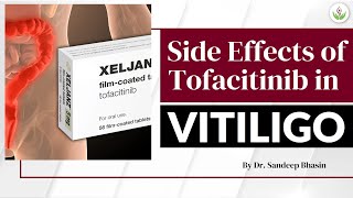 Potential Side Effects of Tofacitinib In Vitiligo  Dr Sandeep Bhasin  Care Well Medical Centre [upl. by Ailedroc984]