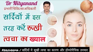 xeroderma  xerosis  dry skin causes symptoms prevention and homoeopathic treatmentdrnityanand [upl. by Stilwell]