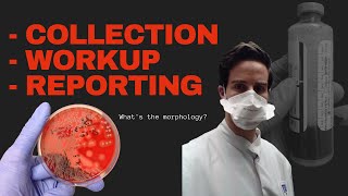 Blood Culture Test Procedure  Microbiology [upl. by Kinson327]