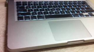 How To Remove Incase  Speck Hardshell Case OFF your Macbook [upl. by Huldah]