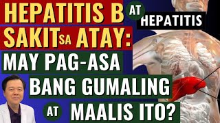 Hepatitis B at Sakit sa Atay May Pagasa bang Gumaling at Maalis Ito  By Doc Willie Ong [upl. by Ahsaela]