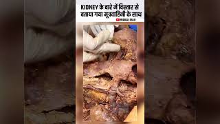 Kidney Explained with Ureter ll Part By Part Define ll Medical dr4u hospital motivation kidney [upl. by Cleopatra957]