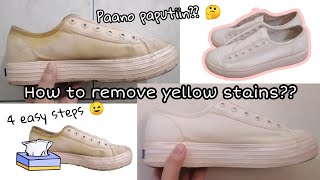 How to remove yellow stains on white shoes 4 Easy Steps [upl. by Grondin]