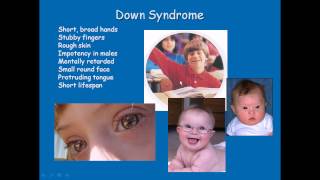 Chromosomal disorders [upl. by Woodruff928]