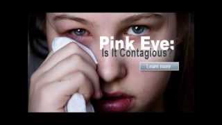 how to get rid of pink eye  conjunctivitis treatment  how to get rid of pink eye fast [upl. by Towny]