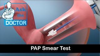 Pap Smear Test [upl. by Atterahs144]