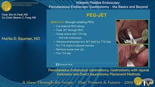 Percutaneous Endoscopic Gastrostomy Gastrostomy with Jejunal Extension [upl. by Hayilaa]