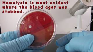 Beta Hemolysis on Blood Agar [upl. by Giana]