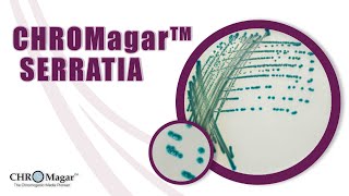 New Chromogenic Media for detection of Serratia marcescens CHROMagar Serratia [upl. by Colly680]