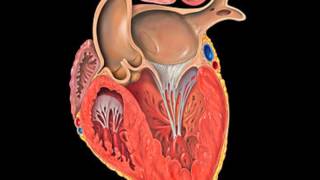 Disjonctor  Ventricule Gauche [upl. by Notffilc]