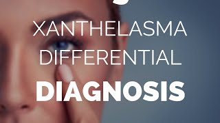 Xanthelasma differential diagnosis what could be the outcome [upl. by Penland990]