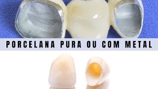 Dentes totalmente de porcelana são melhores Veja aqui e tire suas dúvidas [upl. by Harlow]