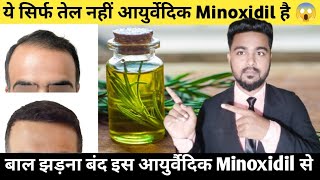 Ayurvedic Minoxidil Hai ye Tel Baalo ka Jhadna Bannd  Minoxidil❌ Ayurvedic Minoxidil ✅ [upl. by Hawker]