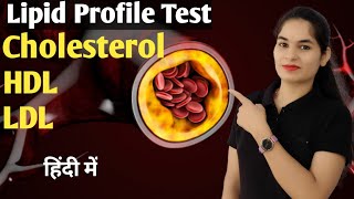 Lipid Profile Test  Cholesterol test  HDL LDL  What is lipid profile test  Biochemistry [upl. by Mada346]