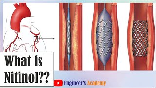 What is Nitinol [upl. by Eatnoled]