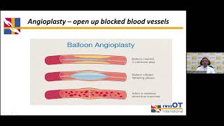 MIOT Hospital amp The Hindu Present Genicular Artery Embolization [upl. by Einiffit]