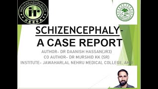 Dr Daanish Hassan quotSCHIZENCEPHALYA CASE REPORTquot [upl. by Ahsauqram779]