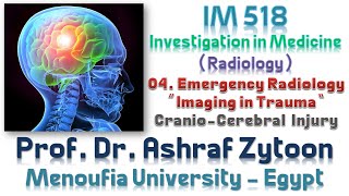 04 Undergraduate Medical Imaging and Radiology Fundamentals  CranioCerebral Injury [upl. by Okiruy]