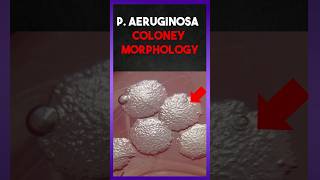 quot pseudomonas aeruginosa quot colony morphology [upl. by Atterahs]