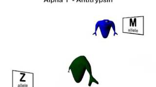 Alpha 1 Antitrypsin Deficiency [upl. by Nivre]