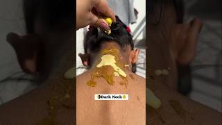 Neck Cleaning Tips amp TrickGet Rid Of Dark Neck Dark Neck Remove Home Remedies shorts viralvideo [upl. by Htiderem]