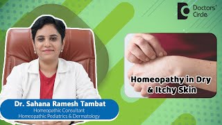 Dry amp Itchy Skin  Best Homeopathic Medicine skin  Dr Sahana Ramesh Tambat  Doctors Circle [upl. by Yllus]