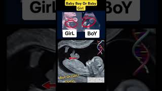 Baby Boy Or Baby Girl pregnancy Ultrasound V4 babyboy babygirl girl boy ultrasound pregnant [upl. by Airotnes]