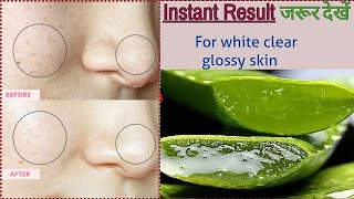 aloe vera gel for skin whitening  aloe vera face pack  aloe vera facial at home [upl. by Cordier]