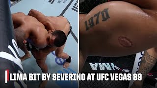 Igor Severino DQ’d for biting Andre Lima on UFCVegas89 prelims  ESPN MMA [upl. by Marcie]