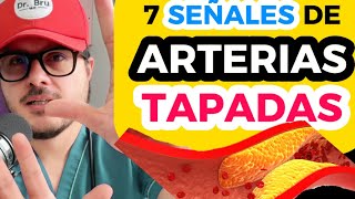 ¡ATENCIÓN ESTOS SÍNTOMAS INDICAN que TIENES ARTERIAS TAPADAS VENAS TAPADAS [upl. by Harneen]