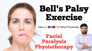 Bells Palsy Exercise  मुँह का एक तरफ का लकवा  Facial Paralaysis Exercise  मुँह के अधरंग के एक्सर [upl. by Auahsoj]