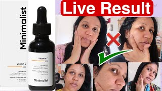 Minimalist 10 Vitamin C Serum Review With One Month Live Results [upl. by Thissa]