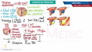 Urología  Cancer de prostata [upl. by Aniuqaoj]