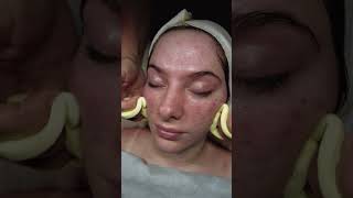 Esthetician 🧘‍♀️ Skin Care ASMR BLOOPERS 🤣 estheticianlife skincareasmr skincaretips [upl. by Ennovart]