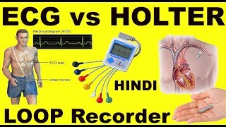 Rx Heart epi 11 h  How to Monitor Heart  ECG vs HOLTER vs LOOP recorder HINDI DrEducation [upl. by Marris]