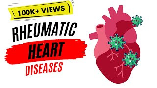 Rheumatic heart disease  Rheumatic fever [upl. by Atiek]