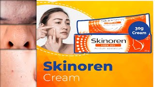 Skinoren cream how to use  Azelaic acid how to use [upl. by Aicilyt]