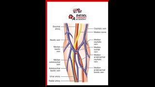 How to Start an IV  Detailed How To Step By Step Video [upl. by Wera63]