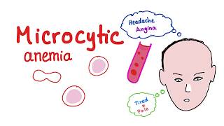 Microcytic Anemia introduction [upl. by Anaujnas]