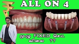 Fixed பல் செட் All On 4 சிகிச்சை செலவு என்ன [upl. by Nosidda]